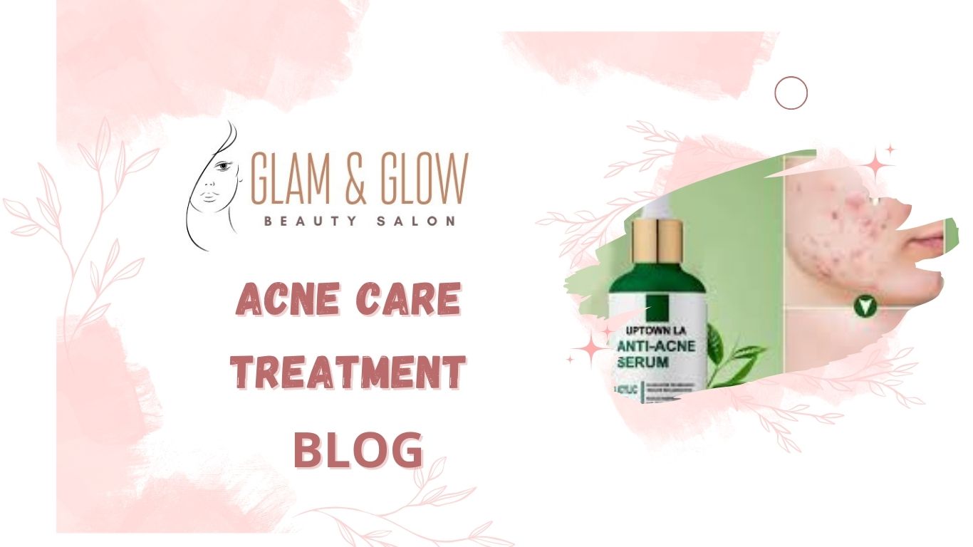 25. ACNE CARE TREATMENT: Your Comprehensive Guide to Clear Skin
